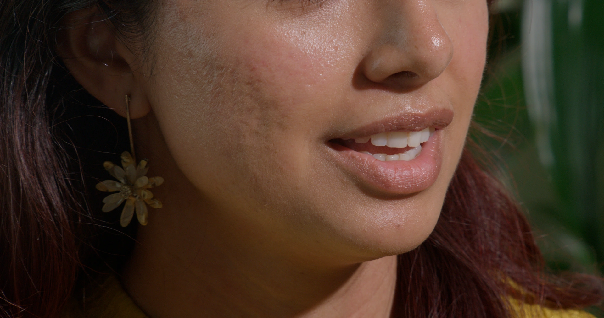 The same profile close-up before DermaGrade skin refinement.